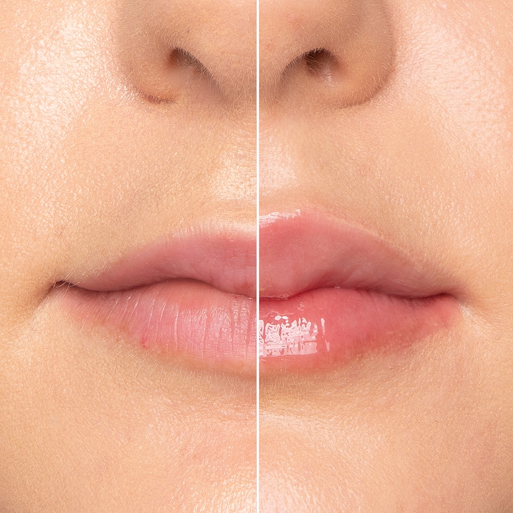 Lip Injection Extreme Lip Plumper