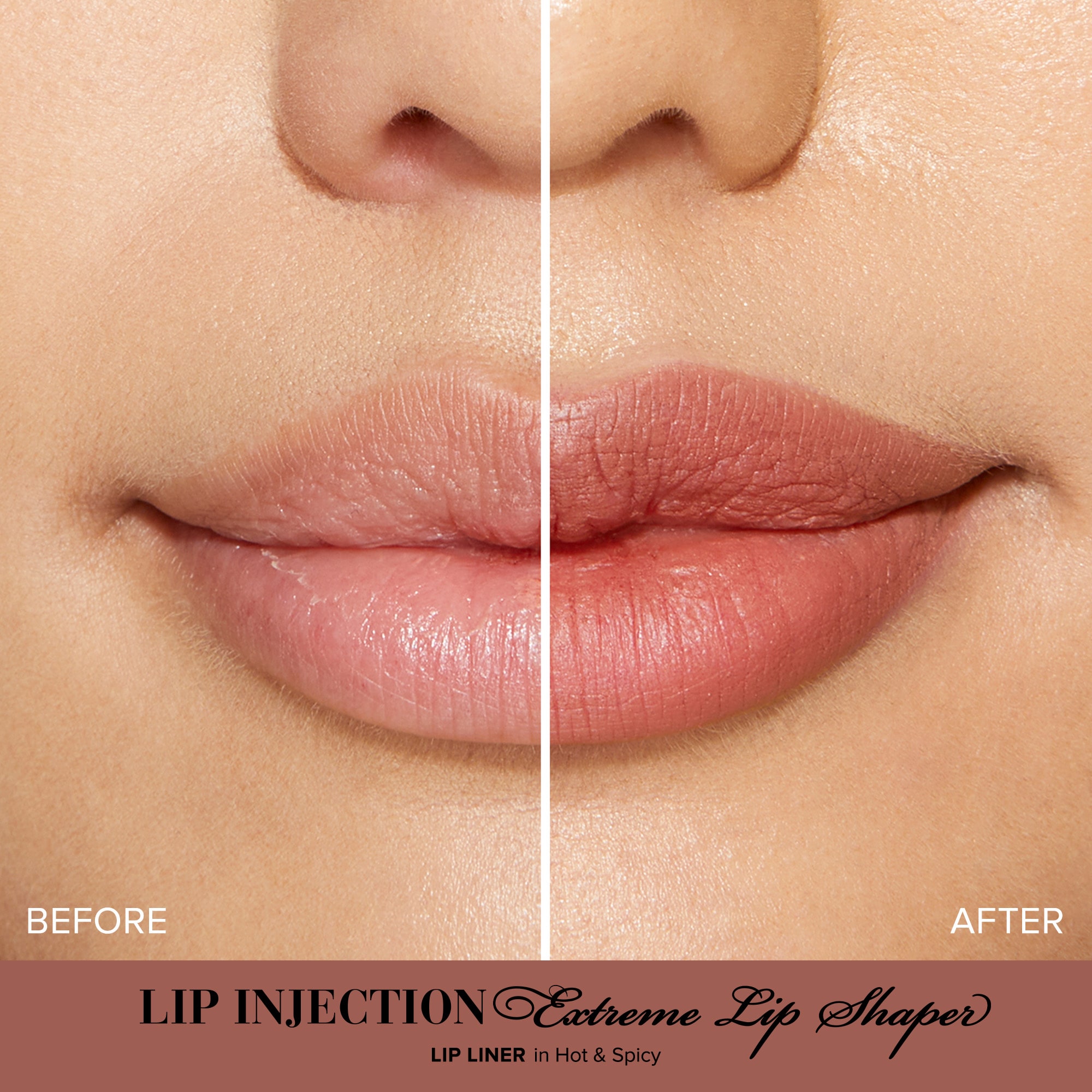 Lip Injection Extreme Lip Shaper