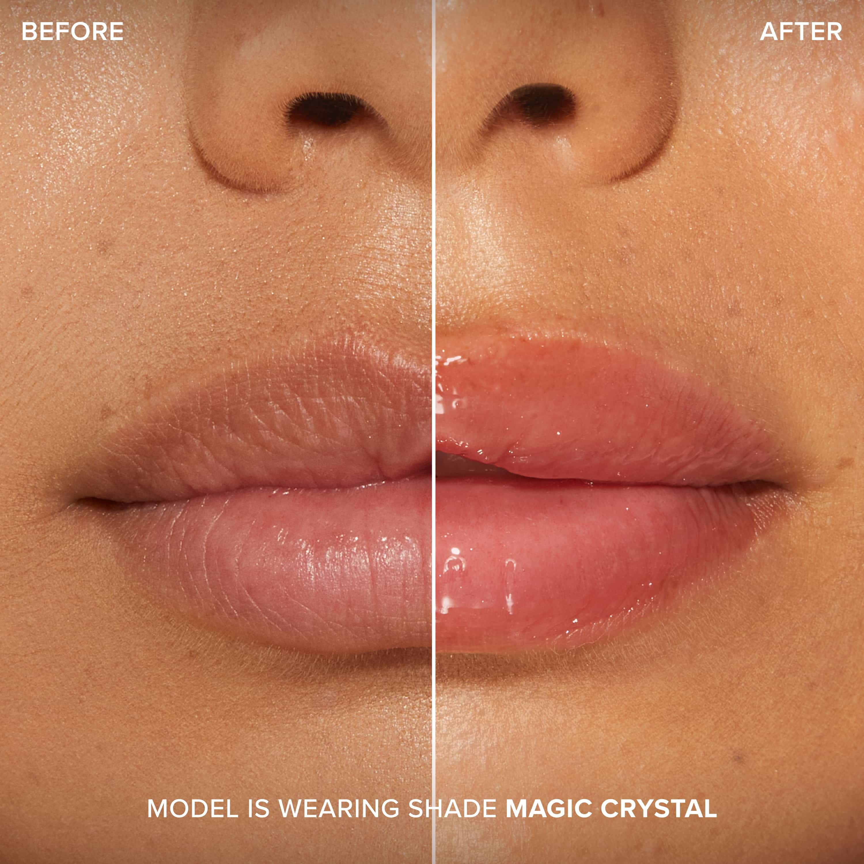 Lip Injection Maximum Plump