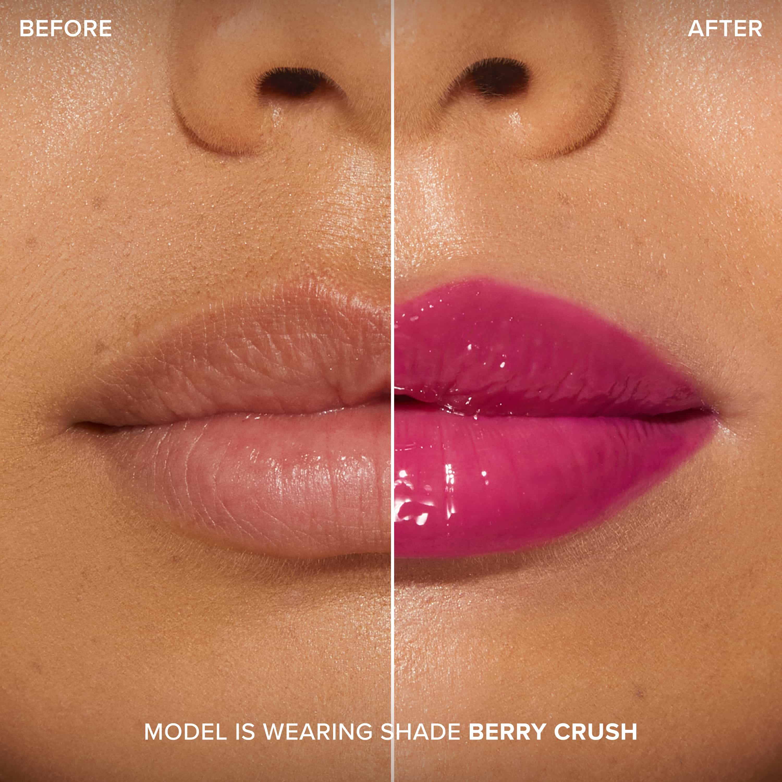 Lip Injection Maximum Plump