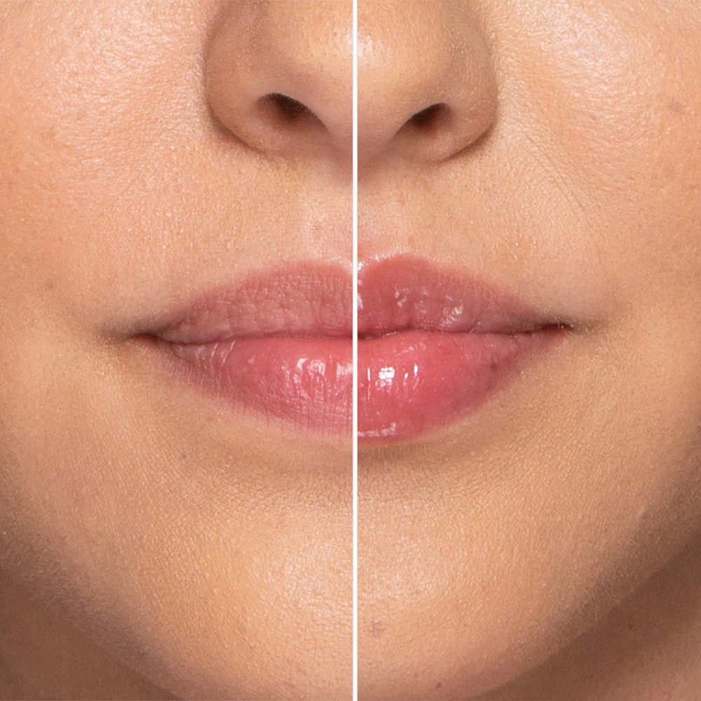 Lip Injection Extreme Lip Plumper